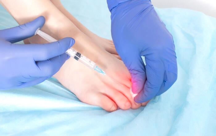 Arthritis Pain Relieve with Ozone Therapy